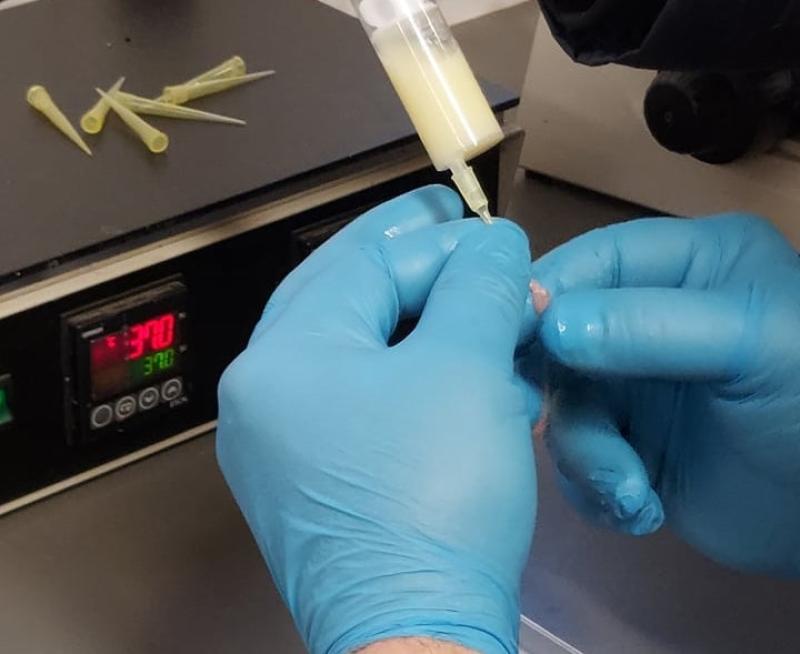 extraction epididymaire